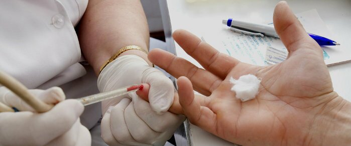 Лечение кори у детей и взрослых, симптомы и осложнения