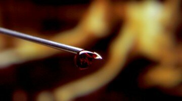 Анализ крови на вирусы