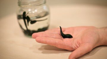 Покормите пиявку, или Особенности гирудотерапии