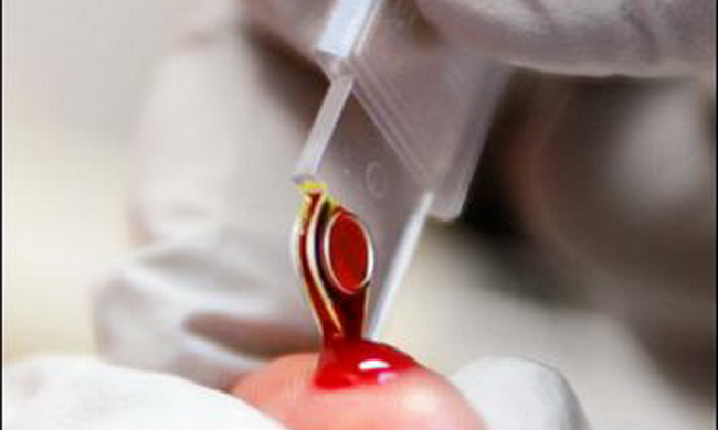 Врач берет кровь на проверку гемоглобина