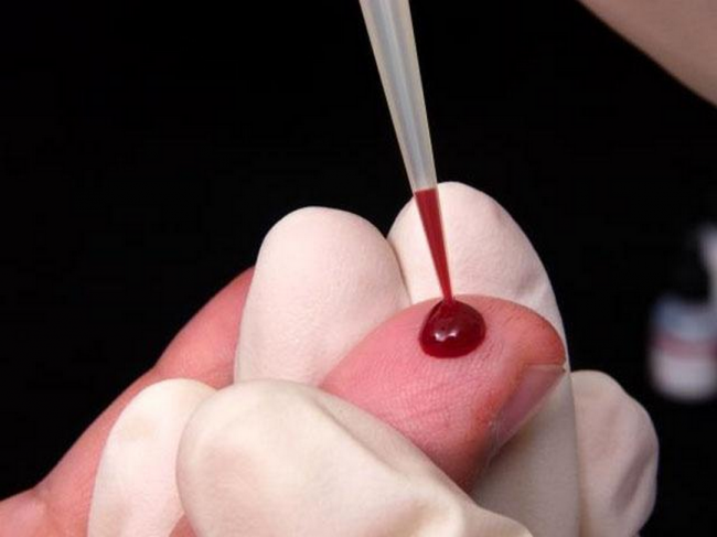 Врач берет кровь из пальца