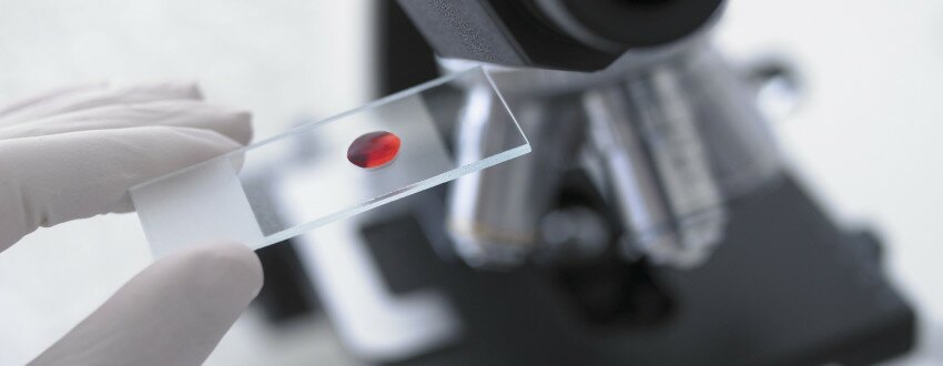 анализ крови