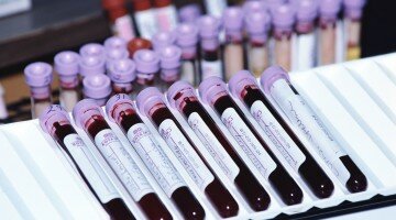 Что такое гидремия и как с ней бороться