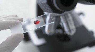 Способы и методики определения гликозилированного гемоглобина в крови