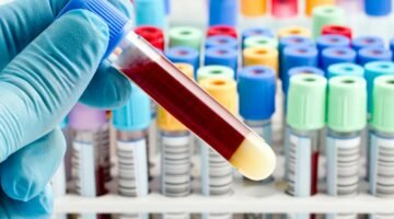 Анализ крови на герпес