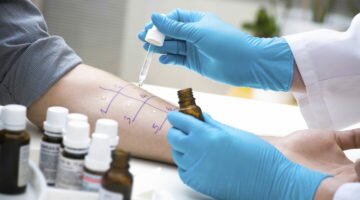 Проведение теста на выявление аллергии