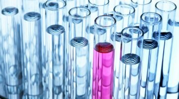 Анализ крови на титры антител