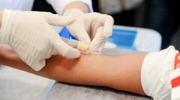 Анализ крови на ВИЧ