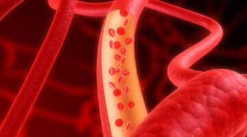 Понижаем гемоглобин народными средствами: проверенные методики в действии