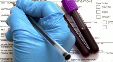 Важность типирования крови для человека