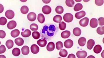 Нормы сегментоядерных нейтрофилов в крови человека