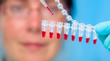 Какая существует зависимость между месячными и анализом?