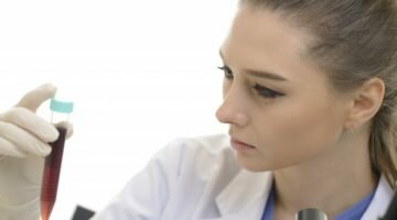 Конечный продукт распада белков — мочевина