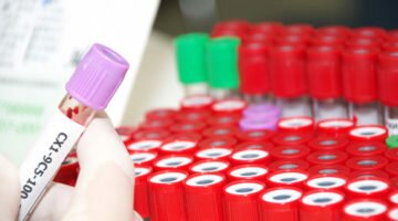 Повышенный гемоглобин у женщин. Причины, симптомы, лечение