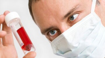 Палочкоядерные нейтрофилы. Что это такое и о чём говорит их повышение?