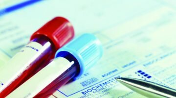 Каковы нормы онкомаркера СА 125 в крови, что говорит повышенный результат?