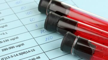 Каковы нормы фибриногена в крови человека и что означает его повышение?