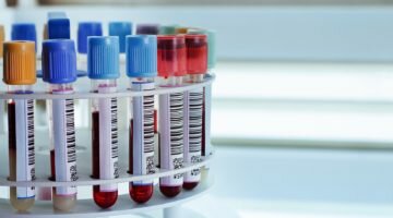 Что такое билирубин и зачем нужно сдавать биохимический анализ на его наличие?