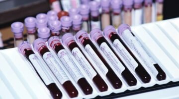 Анализ крови на кариотип