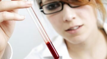 Иммуноглобулин Е в составе крови