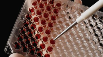 Эритроцитный индекс — MCV