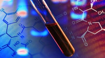 Повышение и норма мочевой кислоты