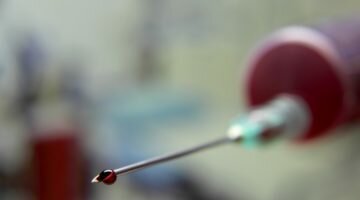 Классификация и типы гиперлипидемии