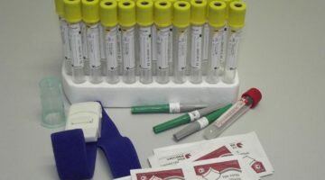 Анализ крови на гомоцистеин