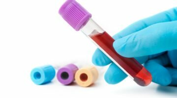 Отклонение и норма креатинина